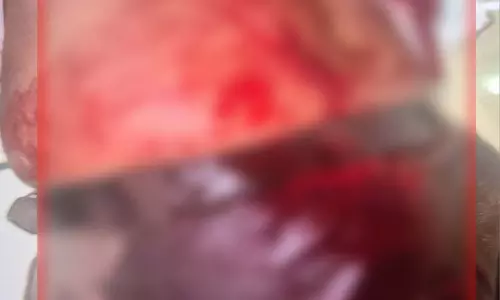 माना के नुक्कड़ कैफे के पीछे युवक पर चाकू से किया हमला माना के नुक्कड़ कैफे के पीछे युवक पर चाकू से किया हमला