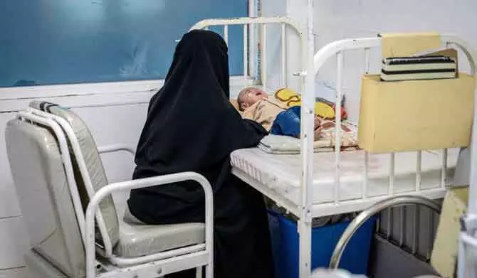 अफ़गानिस्तान में लाखों बच्चे गंभीर कुपोषण का सामना कर रहे हैं , UN अफ़गानिस्तान में लाखों बच्चे गंभीर कुपोषण का सामना कर रहे हैं , UN