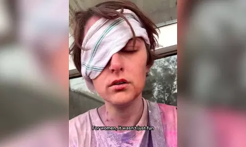 वृंदावन में होली के दिन हुई दुर्घटना में Austrian tourist की आंख में चोट लगी वृंदावन में होली के दिन हुई दुर्घटना में Austrian tourist की आंख में चोट लगी