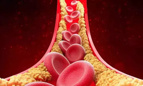 अगर आपका High Cholesterol है तो रोज़ाना ये चीज़ें खाएं अगर आपका High Cholesterol है तो रोज़ाना ये चीज़ें खाएं