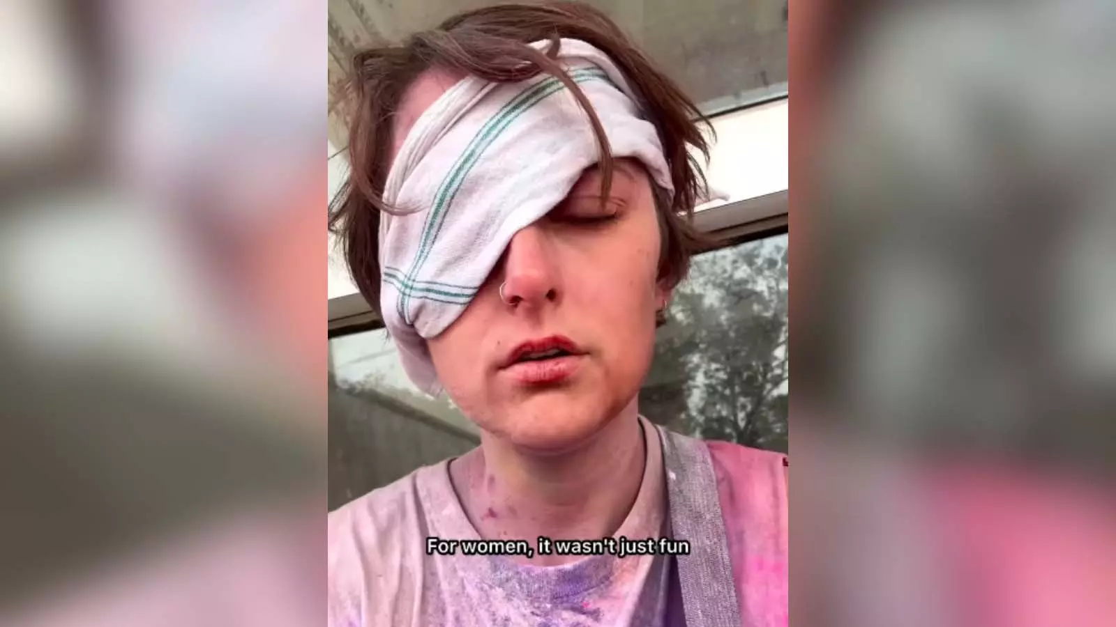 वृंदावन में होली के दिन हुई दुर्घटना में Austrian tourist की आंख में चोट लगी वृंदावन में होली के दिन हुई दुर्घटना में Austrian tourist की आंख में चोट लगी
