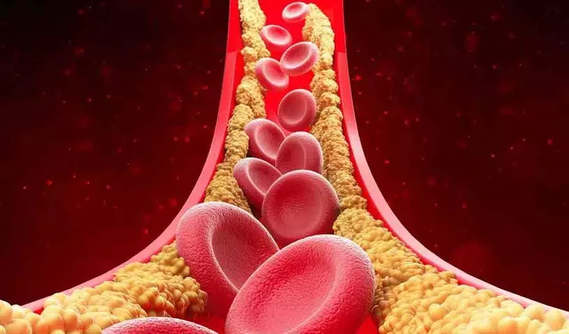 अगर आपका High Cholesterol है तो रोज़ाना ये चीज़ें खाएं अगर आपका High Cholesterol है तो रोज़ाना ये चीज़ें खाएं