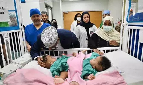 Abdullah Al-Rabeeah की टीम ने सोमाली जुड़वां बच्चियों की सर्जरी शुरू की Abdullah Al-Rabeeah की टीम ने सोमाली जुड़वां बच्चियों की सर्जरी शुरू की