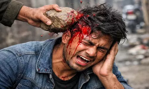 होली में युवक पर पत्थर से हमला, FIR दर्ज होली में युवक पर पत्थर से हमला, FIR दर्ज