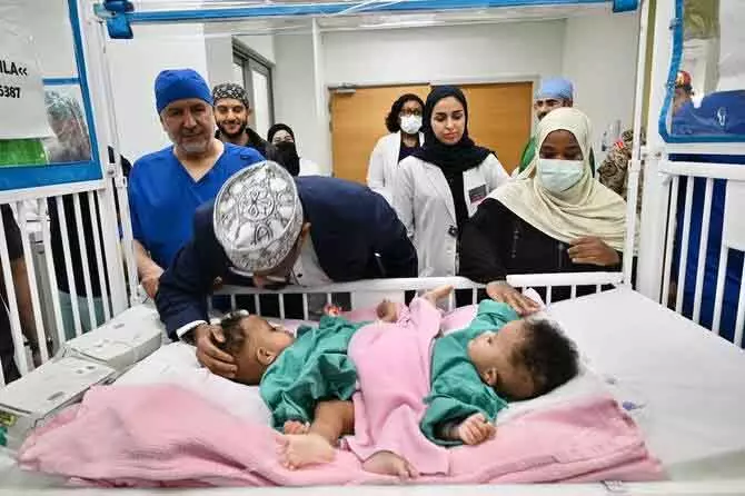 Abdullah Al-Rabeeah की टीम ने सोमाली जुड़वां बच्चियों की सर्जरी शुरू की Abdullah Al-Rabeeah की टीम ने सोमाली जुड़वां बच्चियों की सर्जरी शुरू की