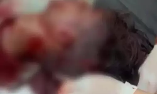 होली पर युवक पर धारदार हथियार से हमला, गंभीर रूप से घायल
