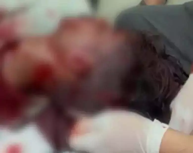 होली पर युवक पर धारदार हथियार से हमला, गंभीर रूप से घायल होली पर युवक पर धारदार हथियार से हमला, गंभीर रूप से घायल