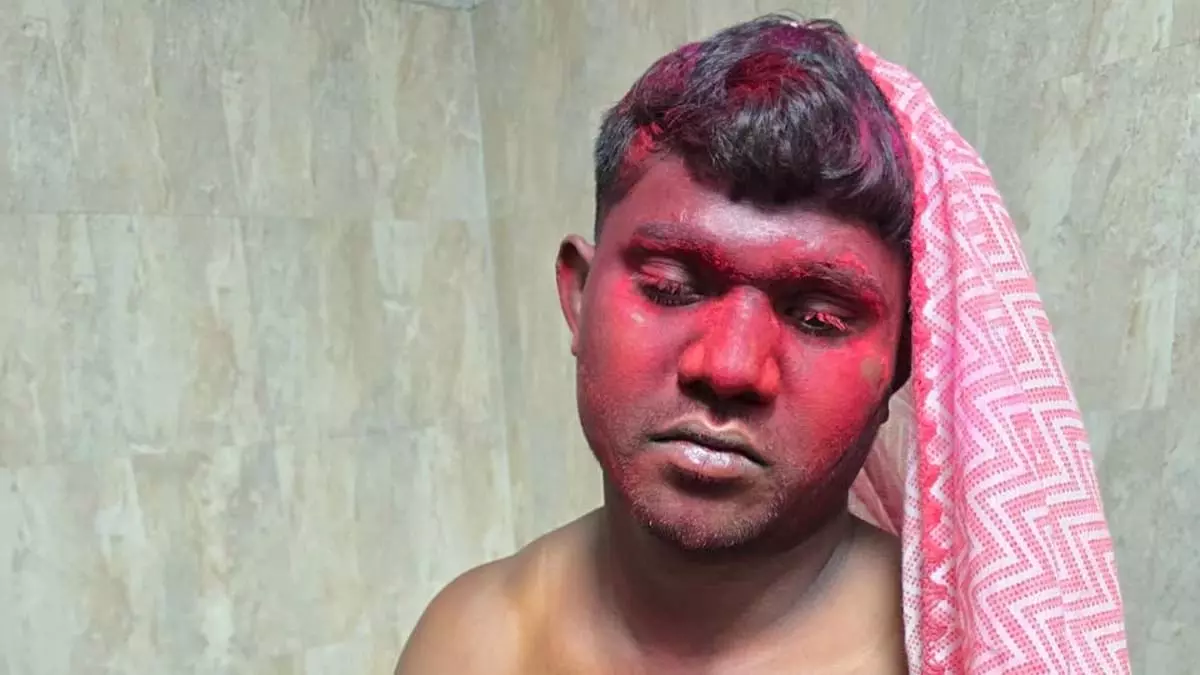 सीने में लकड़ी का टुकड़ा घुसा, इलाज के अभाव में तड़पता रहा घायल युवक सीने में लकड़ी का टुकड़ा घुसा, इलाज के अभाव में तड़पता रहा घायल युवक
