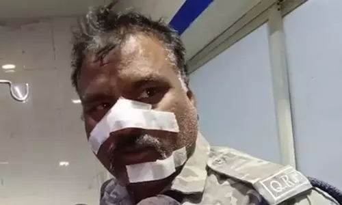 भारत की जीत का जश्न मना रहे लोगों के पटाखे फोड़ने से पुलिसकर्मी घायल भारत की जीत का जश्न मना रहे लोगों के पटाखे फोड़ने से पुलिसकर्मी घायल