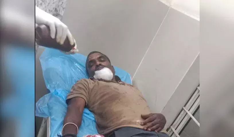Siddipet के पास राजीव राहदारी पर आरटीसी बस और लॉरी में टक्कर, छह घायल Siddipet के पास राजीव राहदारी पर आरटीसी बस और लॉरी में टक्कर, छह घायल