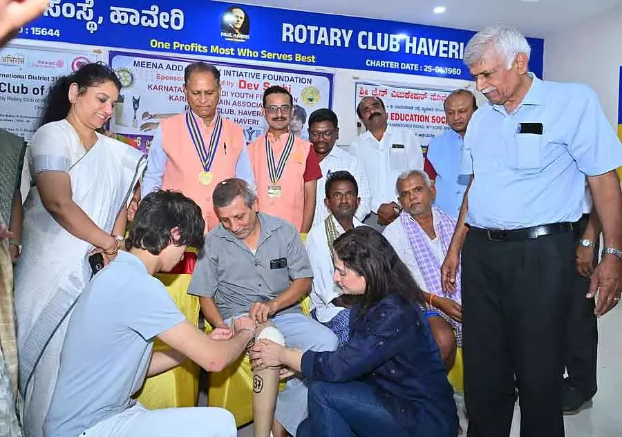 Haveri : 183 लोगों को आर्टिफिशियल लिंब लगाए गए Haveri : 183 लोगों को आर्टिफिशियल लिंब लगाए गए