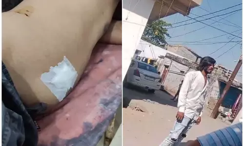 खम्हारडीह इलाके में बलवा, हरनारायण राठौर पर एकतरफा कार्रवाई का आरोप खम्हारडीह इलाके में बलवा, हरनारायण राठौर पर एकतरफा कार्रवाई का आरोप