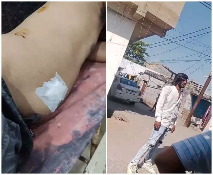 खम्हारडीह इलाके में बलवा, हरनारायण राठौर पर एकतरफा कार्रवाई का आरोप खम्हारडीह इलाके में बलवा, हरनारायण राठौर पर एकतरफा कार्रवाई का आरोप