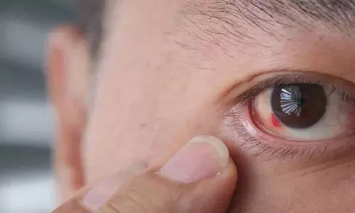 क्या आपको अक्सर अपनी आँखों में ये symptoms दिखते हैं? लेकिन इन्हें नज़रअंदाज़ न करें क्या आपको अक्सर अपनी आँखों में ये symptoms दिखते हैं? लेकिन इन्हें नज़रअंदाज़ न करें