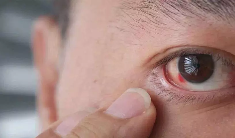 क्या आपको अक्सर अपनी आँखों में ये symptoms दिखते हैं? लेकिन इन्हें नज़रअंदाज़ न करें क्या आपको अक्सर अपनी आँखों में ये symptoms दिखते हैं? लेकिन इन्हें नज़रअंदाज़ न करें