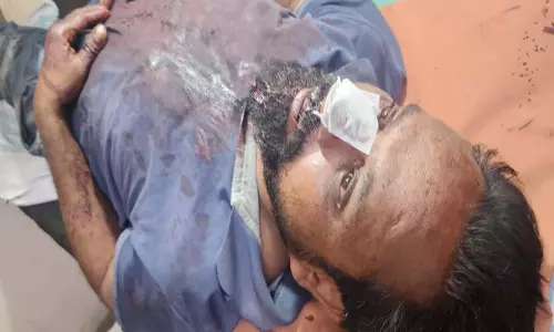 रायपुर में CM हाउस के पास युवक पर चाकू से हमलाकर 15 हज़ार की लूट रायपुर में CM हाउस के पास युवक पर चाकू से हमलाकर 15 हज़ार की लूट