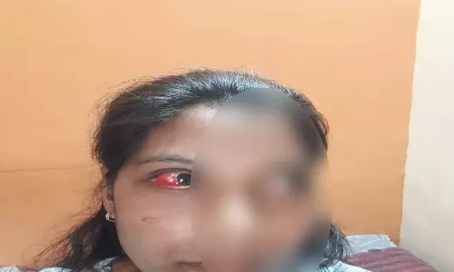महिला के घर घुसकर पडोसी ने आंख में डाला मिर्च पाउडर, चाकू से किया वार महिला के घर घुसकर पडोसी ने आंख में डाला मिर्च पाउडर, चाकू से किया वार