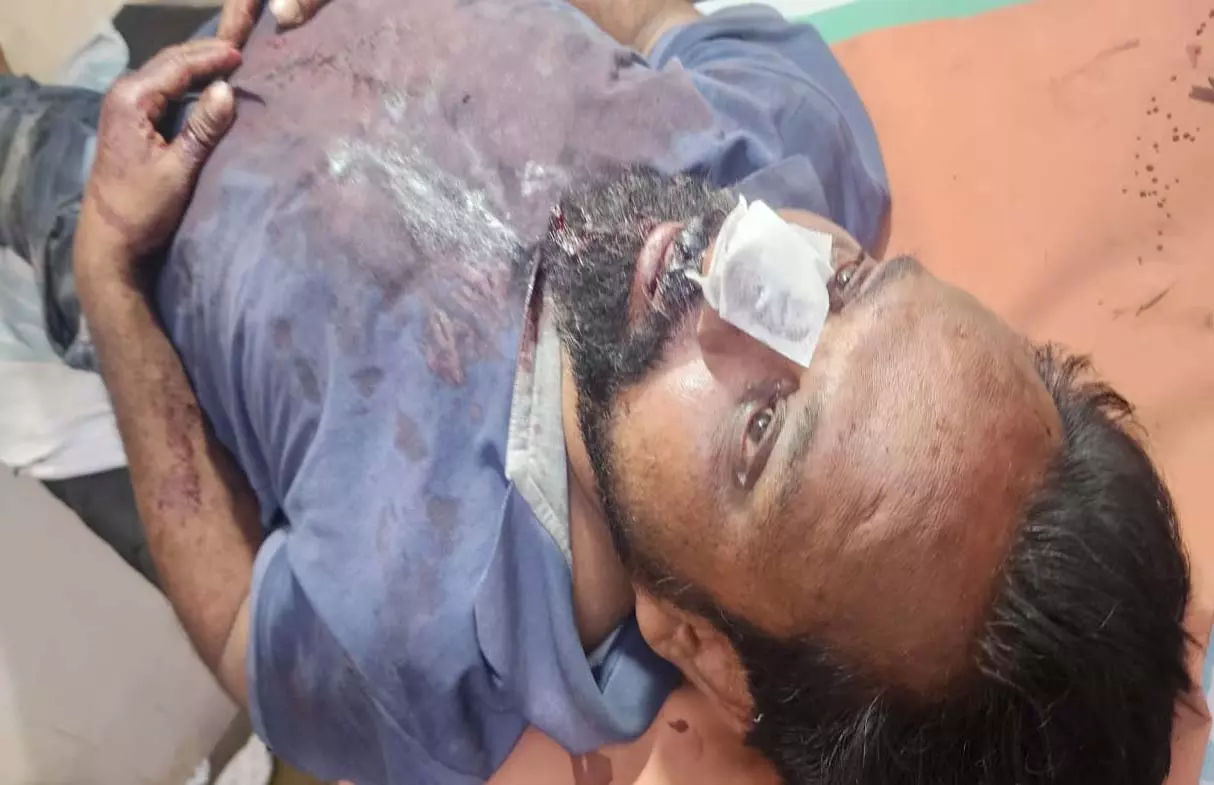 रायपुर में CM हाउस के पास युवक पर चाकू से हमलाकर 15 हज़ार की लूट रायपुर में CM हाउस के पास युवक पर चाकू से हमलाकर 15 हज़ार की लूट
