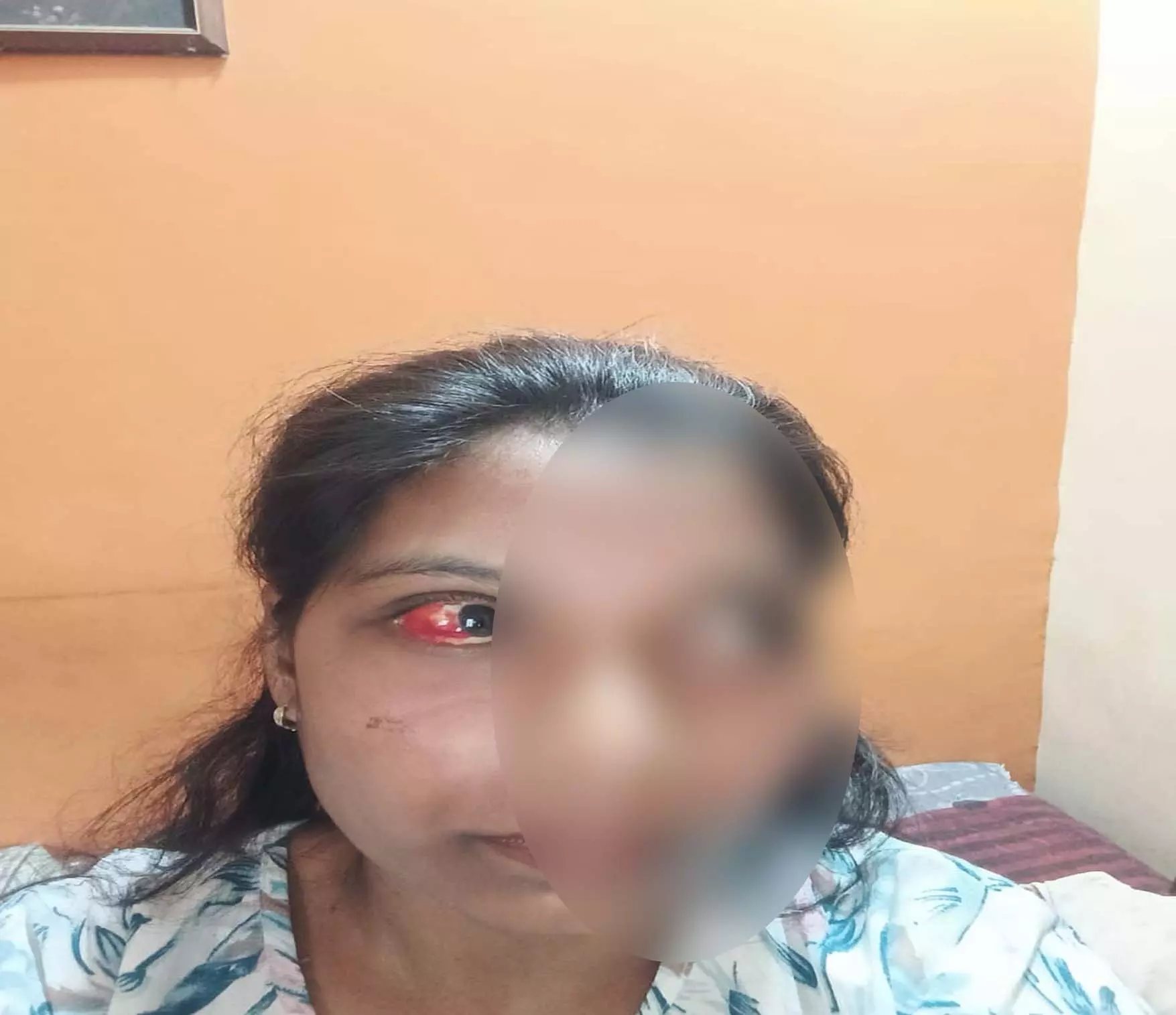 महिला के घर घुसकर पडोसी ने आंख में डाला मिर्च पाउडर, चाकू से किया वार महिला के घर घुसकर पडोसी ने आंख में डाला मिर्च पाउडर, चाकू से किया वार