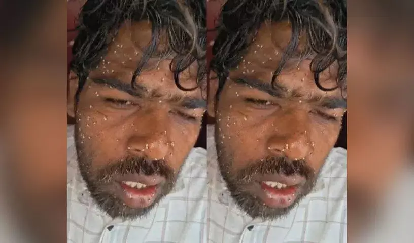 Sangareddy में मधुमक्खियों के हमले में 15 लोग घायल Sangareddy में मधुमक्खियों के हमले में 15 लोग घायल