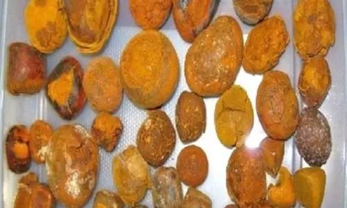 डेढ़ लाख रुपए में गाय की पथरी की नीलामी, अंतरराष्ट्रीय बाजार की कीमत डेढ़ लाख रुपए में गाय की पथरी की नीलामी, अंतरराष्ट्रीय बाजार की कीमत