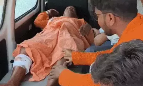 रेलवे स्टेशन में चोरी के प्रयास में गार्ड पर किया जानेलवा हमला, पैर टूटा रेलवे स्टेशन में चोरी के प्रयास में गार्ड पर किया जानेलवा हमला, पैर टूटा