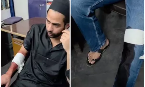 मौदहापारा में चाकूबाजी, दो युवक घायल