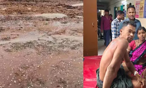 बेमौसम बारिश और ओले, आकाशीय बिजली गिरने से युवक झुलसा बेमौसम बारिश और ओले, आकाशीय बिजली गिरने से युवक झुलसा