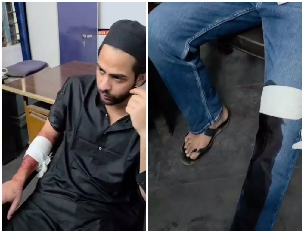 मौदहापारा में चाकूबाजी, दो युवक घायल मौदहापारा में चाकूबाजी, दो युवक घायल