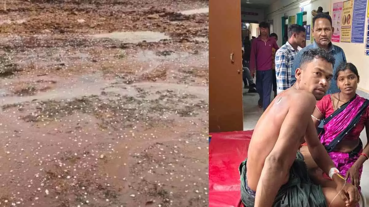 बेमौसम बारिश और ओले, आकाशीय बिजली गिरने से युवक झुलसा बेमौसम बारिश और ओले, आकाशीय बिजली गिरने से युवक झुलसा