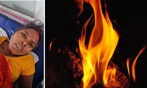 MP : बागेश्वर धाम में आरती के दौरान साड़ी में आग लगने से महिला गंभीर रूप से झुलसी MP : बागेश्वर धाम में आरती के दौरान साड़ी में आग लगने से महिला गंभीर रूप से झुलसी