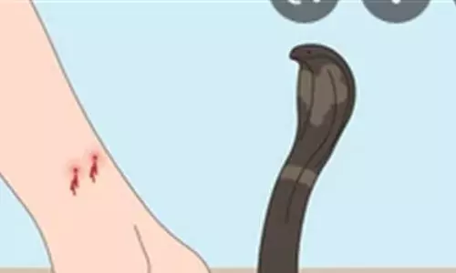 सर्पदंश से पार्षद के मासूम बेटे की मौत