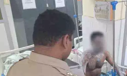 शक का खौफनाक अंजाम...तेजाब से जानलेवा हमला किया