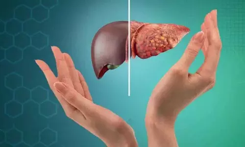 भारत में Fatty Liver की समस्या दिन-ब-दिन बढ़ती जा रही है; अपने खान-पान में ये बदलाव करें भारत में Fatty Liver की समस्या दिन-ब-दिन बढ़ती जा रही है; अपने खान-पान में ये बदलाव करें
