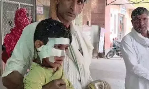 आवारा कुत्ते ने 7 साल के बच्चे पर किया हमला, आंख और हाथ-गर्दन पर गंभीर चोटें