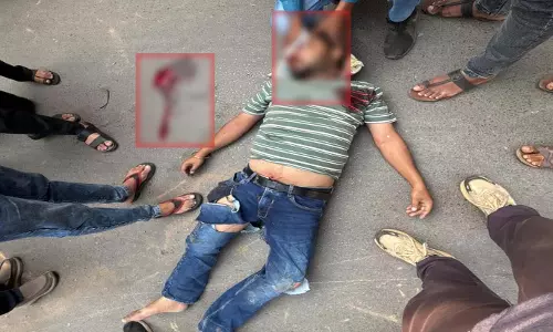 मोपेड सवार गंभीर हादसे का शिकार, घायल सड़क पर पड़ा रहा, किसी ने नहीं की मदद मोपेड सवार गंभीर हादसे का शिकार, घायल सड़क पर पड़ा रहा, किसी ने नहीं की मदद