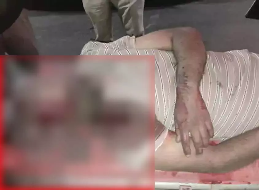 दुर्ग में भीषण सड़क हादसों में ट्रांसपोर्टर समेत दो की मौत दुर्ग में भीषण सड़क हादसों में ट्रांसपोर्टर समेत दो की मौत