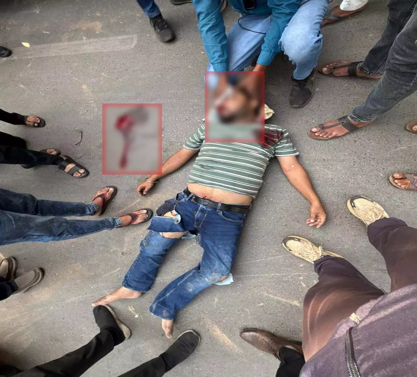 मोपेड सवार गंभीर हादसे का शिकार, घायल सड़क पर पड़ा रहा, किसी ने नहीं की मदद मोपेड सवार गंभीर हादसे का शिकार, घायल सड़क पर पड़ा रहा, किसी ने नहीं की मदद