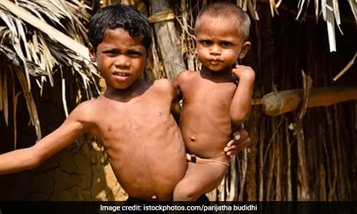 राय : बच्चों में लगातार कुपोषण के बीच भारत की मानव पूंजी का निर्माण