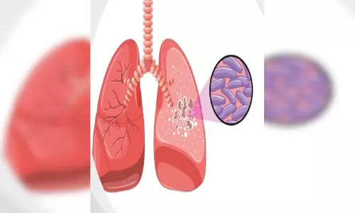 क्या है लेटेंट टीबी? नजरअंदाज करना पड़ सकता है भारी, जानें लक्षण और बचाव क्या है लेटेंट टीबी? नजरअंदाज करना पड़ सकता है भारी, जानें लक्षण और बचाव