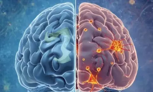 वैज्ञानिकों ने मस्तिष्क में एक डेथ स्विच की पहचान की है, जो Alzheimer के बढ़ने से जुड़ा वैज्ञानिकों ने मस्तिष्क में एक डेथ स्विच की पहचान की है, जो Alzheimer के बढ़ने से जुड़ा
