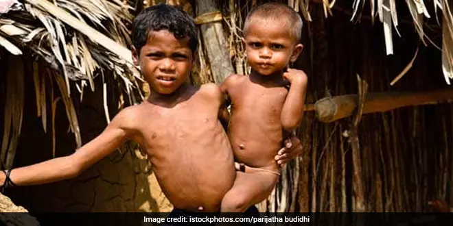 राय : बच्चों में लगातार कुपोषण के बीच भारत की मानव पूंजी का निर्माण राय : बच्चों में लगातार कुपोषण के बीच भारत की मानव पूंजी का निर्माण