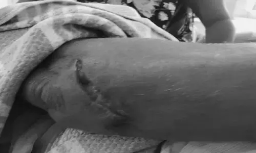 Kattangur: चेर्वुआनाराम गांव में बंदर के हमले से महिला घायल Kattangur: चेर्वुआनाराम गांव में बंदर के हमले से महिला घायल