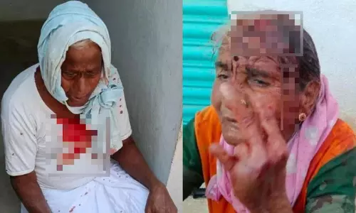 Medak जिला के गांव में बुज़ुर्ग दंपति पर हमला, मंगलसूत्र लूट Medak जिला के गांव में बुज़ुर्ग दंपति पर हमला, मंगलसूत्र लूट