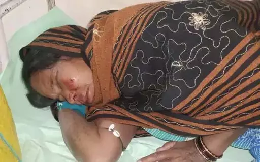 रौंदने के लिए हाथी ने दौड़ाया, रायगढ़ में महिला घायल रौंदने के लिए हाथी ने दौड़ाया, रायगढ़ में महिला घायल