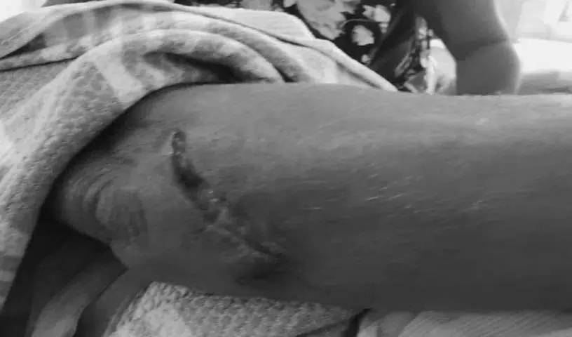 Kattangur: चेर्वुआनाराम गांव में बंदर के हमले से महिला घायल Kattangur: चेर्वुआनाराम गांव में बंदर के हमले से महिला घायल