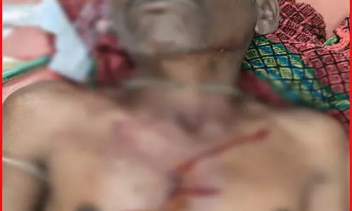 महुआ बीनते समय भालू का हमला, दो ग्रामीण घायल, एक की हालत गंभीर महुआ बीनते समय भालू का हमला, दो ग्रामीण घायल, एक की हालत गंभीर