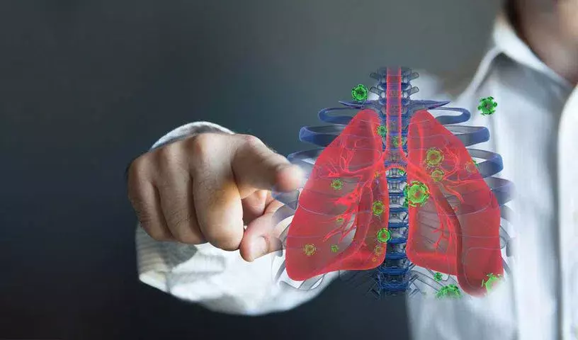प्रोग्रेस के बावजूद भारत का टीबी उन्मूलन लक्ष्य अभी भी मुश्किल बना हुआ प्रोग्रेस के बावजूद भारत का टीबी उन्मूलन लक्ष्य अभी भी मुश्किल बना हुआ