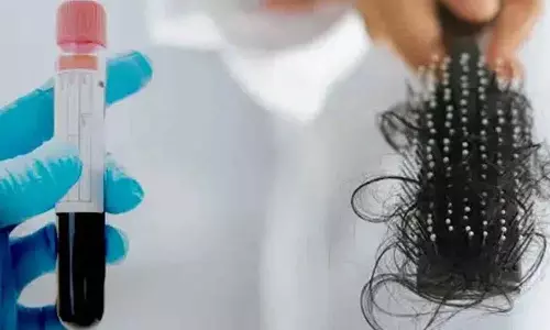 जिन लोगों के बाल झड़ रहे हैं, उन्हें कौन से medical test करवाने चाहिए?