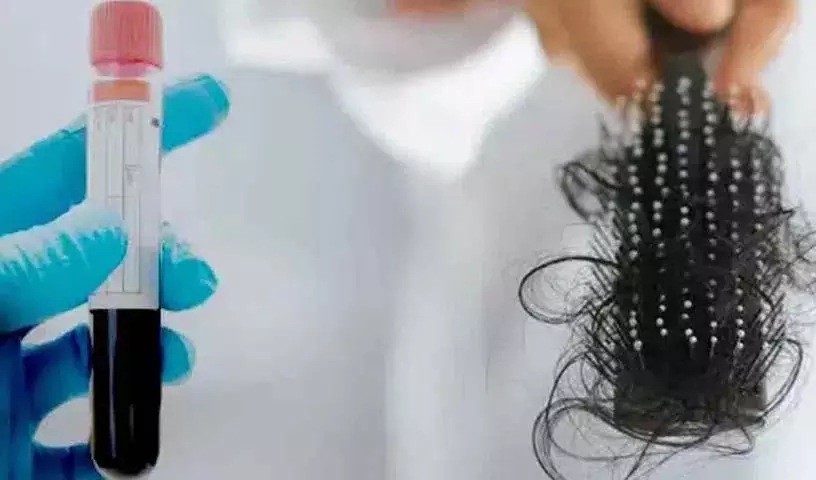 जिन लोगों के बाल झड़ रहे हैं, उन्हें कौन से medical test करवाने चाहिए? जिन लोगों के बाल झड़ रहे हैं, उन्हें कौन से medical test करवाने चाहिए?